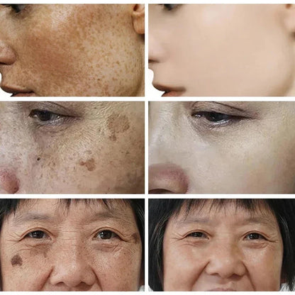 Niacinamide Face Lightening Cream-1