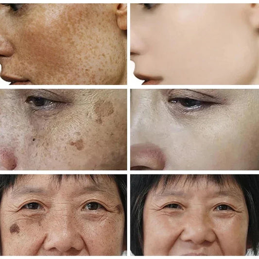 Niacinamide Face Lightening Cream-1