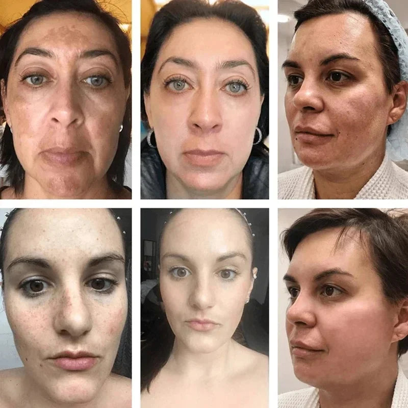 Niacinamide Face Lightening Cream-2