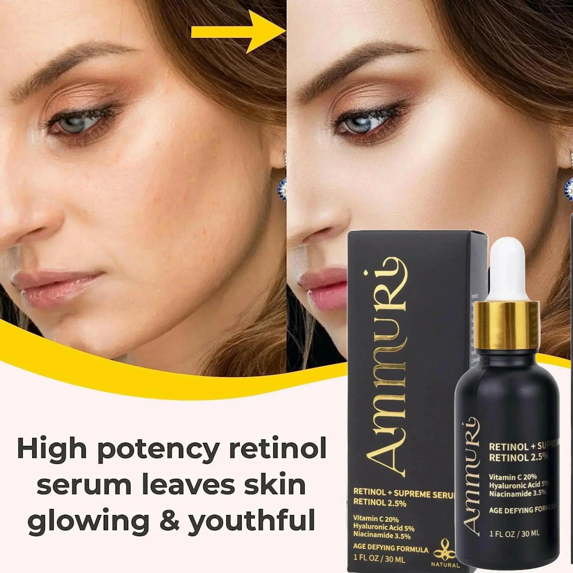 Ammuri Retinol Supreme 2.5% Serum – Anti-Aging Treatment - Age-Defying Formula Ammuri Skincare
