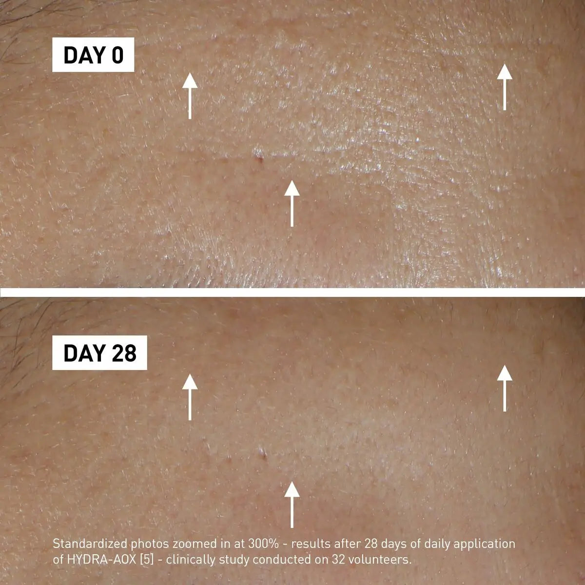 Day Cream Filorga Aox Filorga