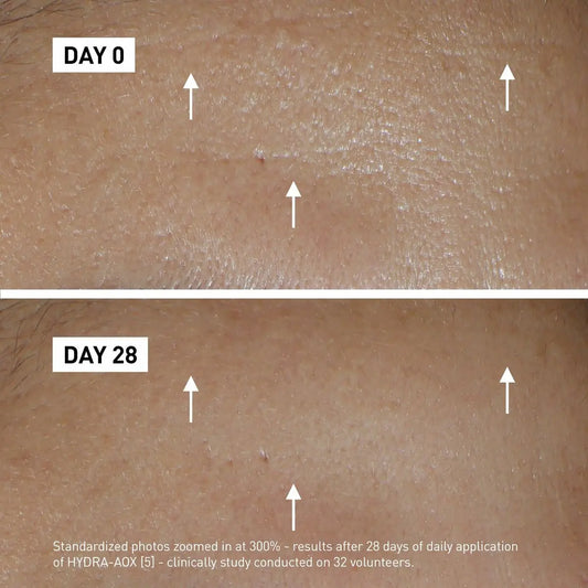 Day Cream Filorga Aox Filorga