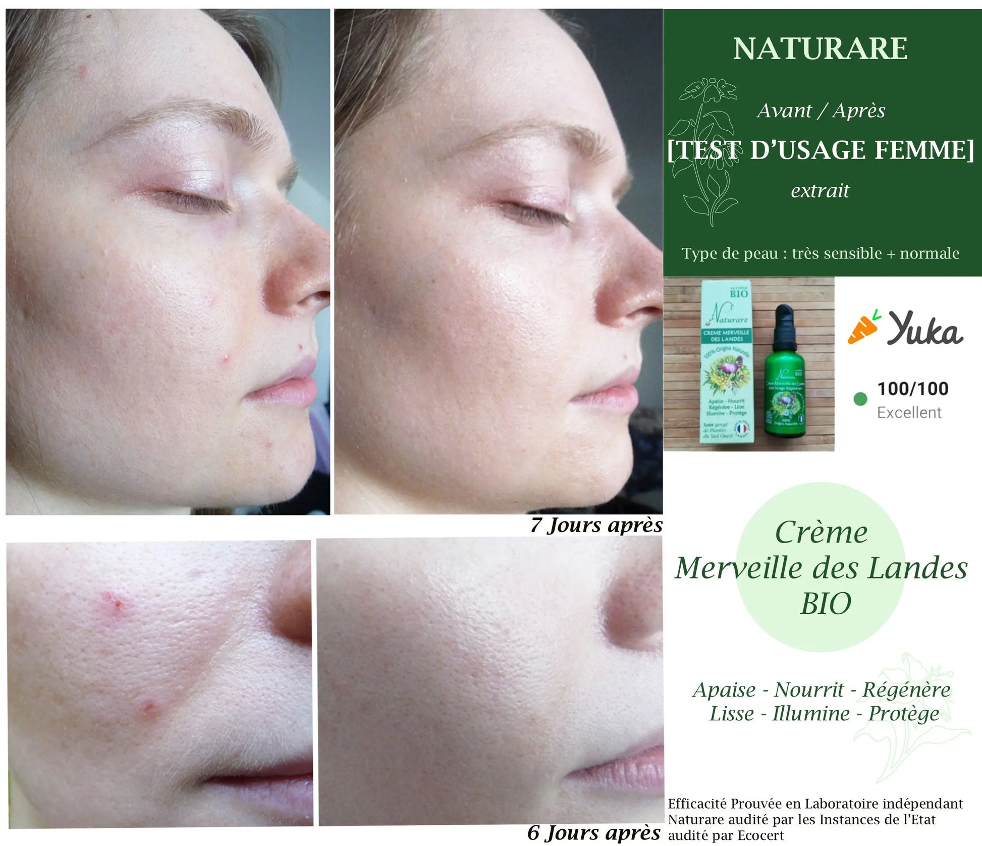 DROP - MERVEILLE DES LANDES BIO - Sensitive skin care Complete regeneration Naturare.fr