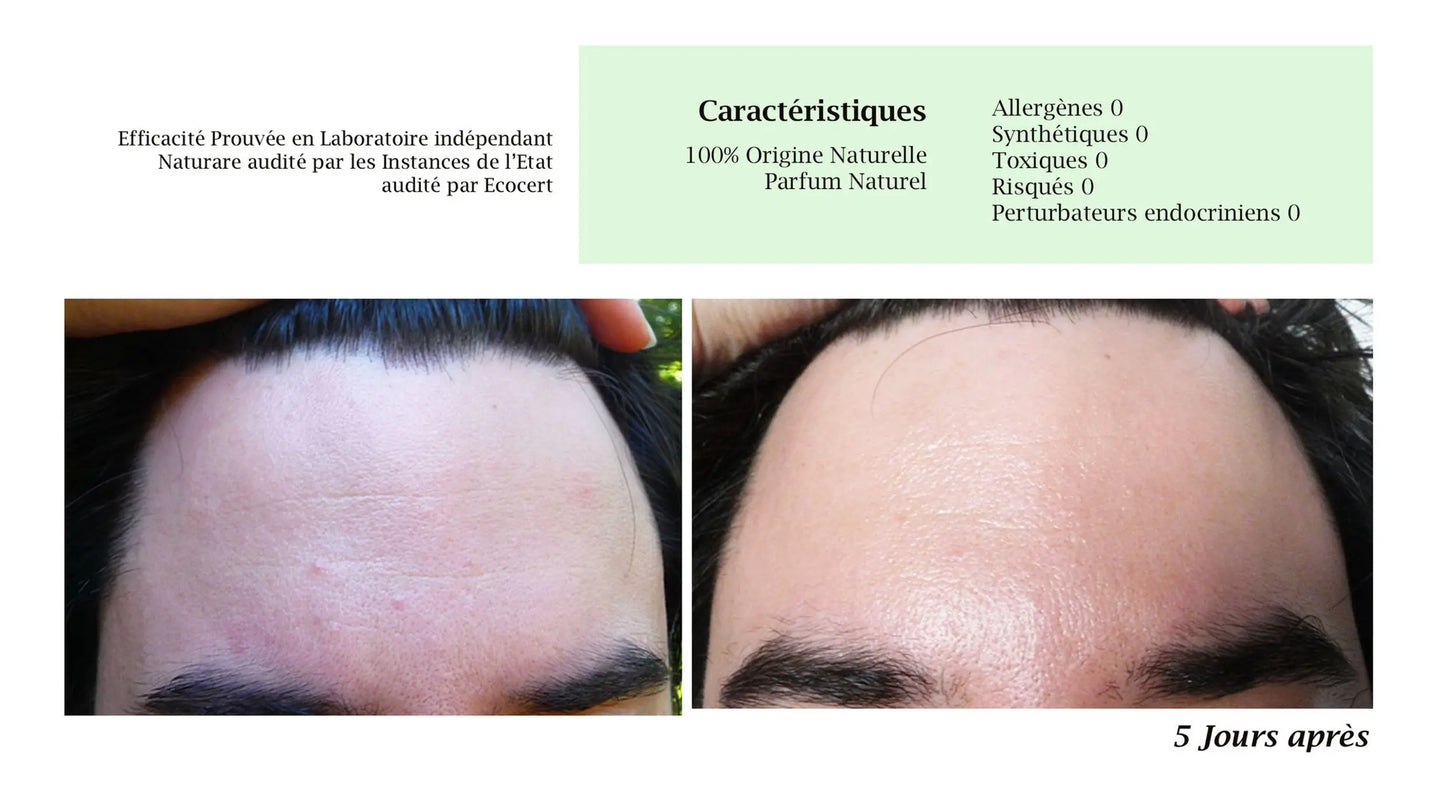 DROP - MERVEILLE DES LANDES BIO - Sensitive skin care Complete regeneration Naturare.fr