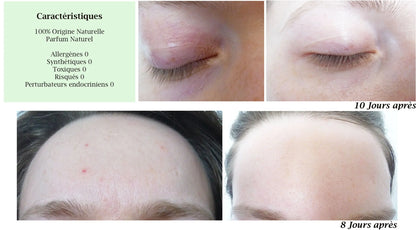 DROP - MERVEILLE DES LANDES BIO - Sensitive skin care Complete regeneration Naturare.fr